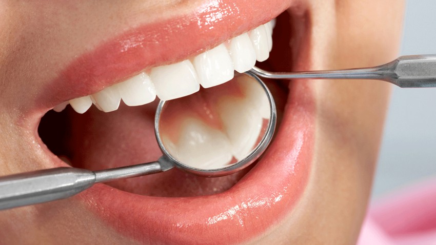 Cabinet-dentaire-Dr. JihaneOUEDGHIRI-soins dentaire